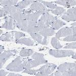 IFNAR1 Antibody in Immunohistochemistry (Paraffin) (IHC (P))