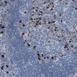 IFNAR1 Antibody in Immunohistochemistry (Paraffin) (IHC (P))