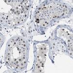 SETDB1 Antibody in Immunohistochemistry (Paraffin) (IHC (P))