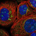 Cathepsin B Antibody in Immunocytochemistry (ICC/IF)