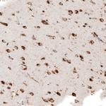 Cathepsin B Antibody in Immunohistochemistry (Paraffin) (IHC (P))