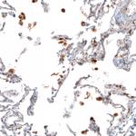 Cathepsin B Antibody in Immunohistochemistry (Paraffin) (IHC (P))