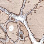 Cathepsin B Antibody in Immunohistochemistry (Paraffin) (IHC (P))