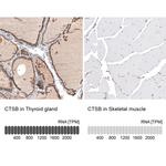 Cathepsin B Antibody