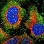 IL-16 Antibody in Immunocytochemistry (ICC/IF)