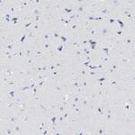 IL-16 Antibody in Immunohistochemistry (Paraffin) (IHC (P))