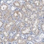 IL-16 Antibody in Immunohistochemistry (Paraffin) (IHC (P))