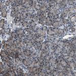 PDCD5 Antibody in Immunohistochemistry (Paraffin) (IHC (P))