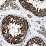 PDCD5 Antibody in Immunohistochemistry (Paraffin) (IHC (P))