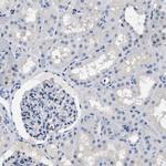 BOLL Antibody in Immunohistochemistry (Paraffin) (IHC (P))