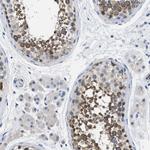 BOLL Antibody in Immunohistochemistry (Paraffin) (IHC (P))