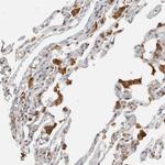 CAPG Antibody in Immunohistochemistry (Paraffin) (IHC (P))