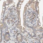 CAPG Antibody in Immunohistochemistry (Paraffin) (IHC (P))