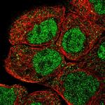 RNF12 Antibody in Immunocytochemistry (ICC/IF)