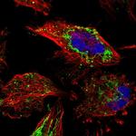 ETFB Antibody in Immunocytochemistry (ICC/IF)