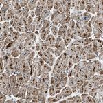 ETFB Antibody in Immunohistochemistry (Paraffin) (IHC (P))