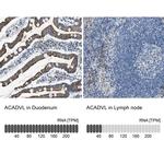 ACADVL Antibody