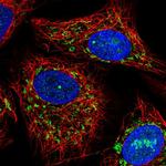 ACADVL Antibody in Immunocytochemistry (ICC/IF)