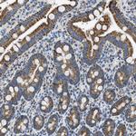 ACADVL Antibody in Immunohistochemistry (Paraffin) (IHC (P))