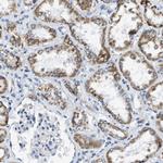 ACADVL Antibody in Immunohistochemistry (Paraffin) (IHC (P))