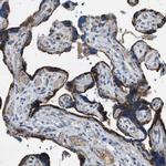 ACADVL Antibody in Immunohistochemistry (Paraffin) (IHC (P))