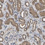 LDHB Antibody in Immunohistochemistry (Paraffin) (IHC (P))