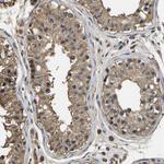 LDHB Antibody in Immunohistochemistry (Paraffin) (IHC (P))