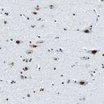 TOP1 Antibody in Immunohistochemistry (Paraffin) (IHC (P))