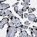 TOP1 Antibody in Immunohistochemistry (Paraffin) (IHC (P))