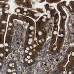 CALM Antibody in Immunohistochemistry (Paraffin) (IHC (P))