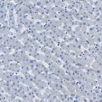 CAPG Antibody in Immunohistochemistry (Paraffin) (IHC (P))