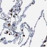 CAPG Antibody in Immunohistochemistry (Paraffin) (IHC (P))