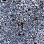 CAPG Antibody in Immunohistochemistry (Paraffin) (IHC (P))