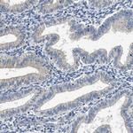 INHA Antibody in Immunohistochemistry (Paraffin) (IHC (P))