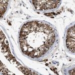 INHA Antibody in Immunohistochemistry (Paraffin) (IHC (P))