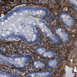 COL6A1 Antibody in Immunohistochemistry (Paraffin) (IHC (P))