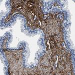 COL6A1 Antibody in Immunohistochemistry (Paraffin) (IHC (P))