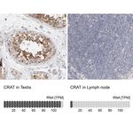 CAT1 Antibody