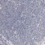 CAT1 Antibody in Immunohistochemistry (Paraffin) (IHC (P))