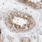 CAT1 Antibody in Immunohistochemistry (Paraffin) (IHC (P))