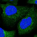 Aconitase 1 Antibody in Immunocytochemistry (ICC/IF)