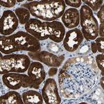 Aconitase 1 Antibody in Immunohistochemistry (Paraffin) (IHC (P))