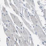 Aconitase 1 Antibody in Immunohistochemistry (Paraffin) (IHC (P))