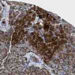 SLIT2 Antibody in Immunohistochemistry (Paraffin) (IHC (P))