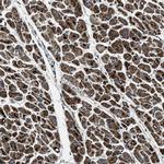 OGDH Antibody in Immunohistochemistry (Paraffin) (IHC (P))