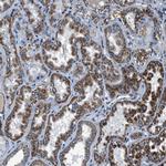 OGDH Antibody in Immunohistochemistry (Paraffin) (IHC (P))