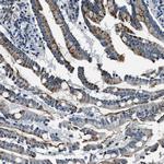 OGDH Antibody in Immunohistochemistry (Paraffin) (IHC (P))