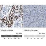 AMACR Antibody