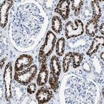 AMACR Antibody in Immunohistochemistry (Paraffin) (IHC (P))