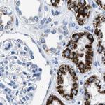 AMACR Antibody in Immunohistochemistry (Paraffin) (IHC (P))